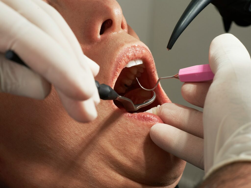sedation
